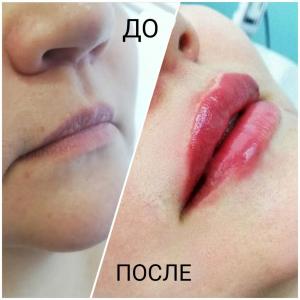 Фотография ЭстетикаСтудия 5