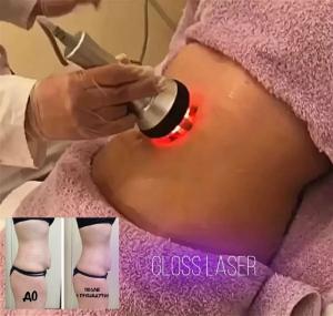 Фотография Gloss Laser 3