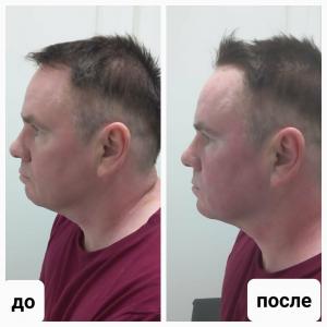 Фотография Студия современной косметологии 5