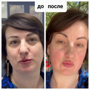 Фотография Студия современной косметологии 4