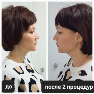 Фотография Студия современной косметологии 3