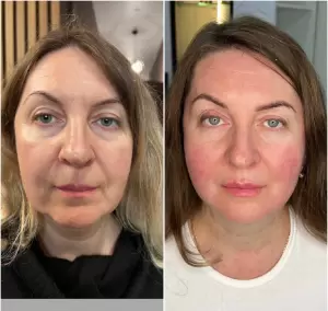 Фотография Территория красоты 3